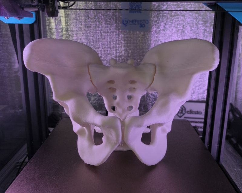 Pelvis completa — vista lateral